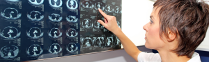Usach impulsa IA para optimizar tomografías y reducir la exposición de los pacientes a la radiación